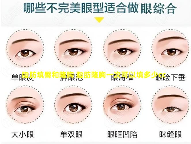 脂肪填臀和隆胸 脂肪隆胸一次可以填多少cc